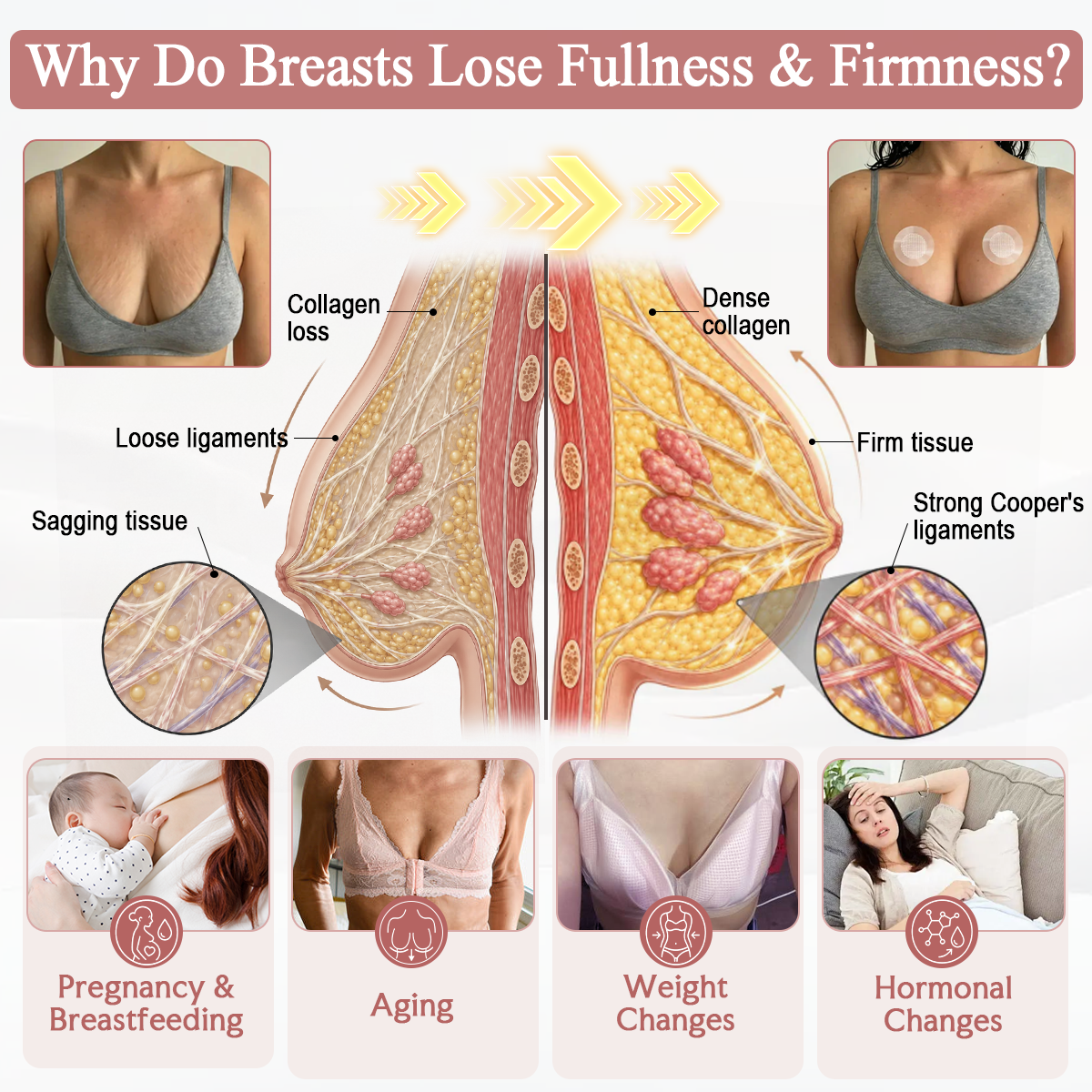 HISKIN® BREAST ENHANCEMENT  LIFT & FIRM MICRONEEDLE PATCHES