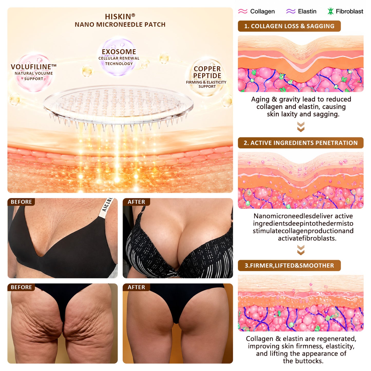 HISKIN® Bust Volume, Lift & Firming Nano Microneedle Patch Volufiline + Exosome + Copper Peptide Formula Powered by Cellular Renewal Technology (Copy)