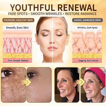 HISKIN® Bust Volume, Lift & Firming Nano Microneedle Patch Volufiline + Exosome + Copper Peptide Formula Powered by Cellular Renewal Technology (Copy)