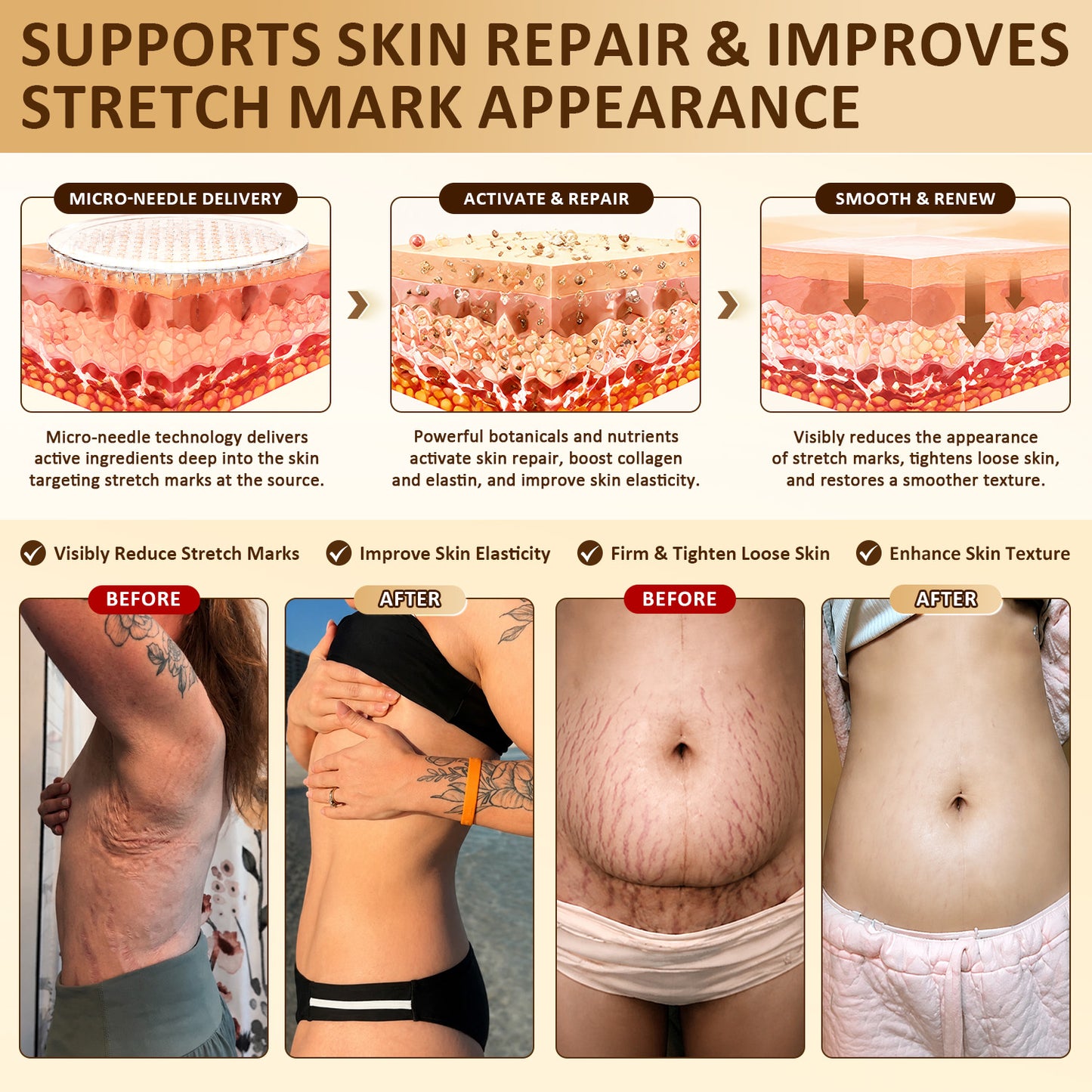 HISKIN® Bust Volume, Lift & Firming Nano Microneedle Patch Volufiline + Exosome + Copper Peptide Formula Powered by Cellular Renewal Technology (Copy)