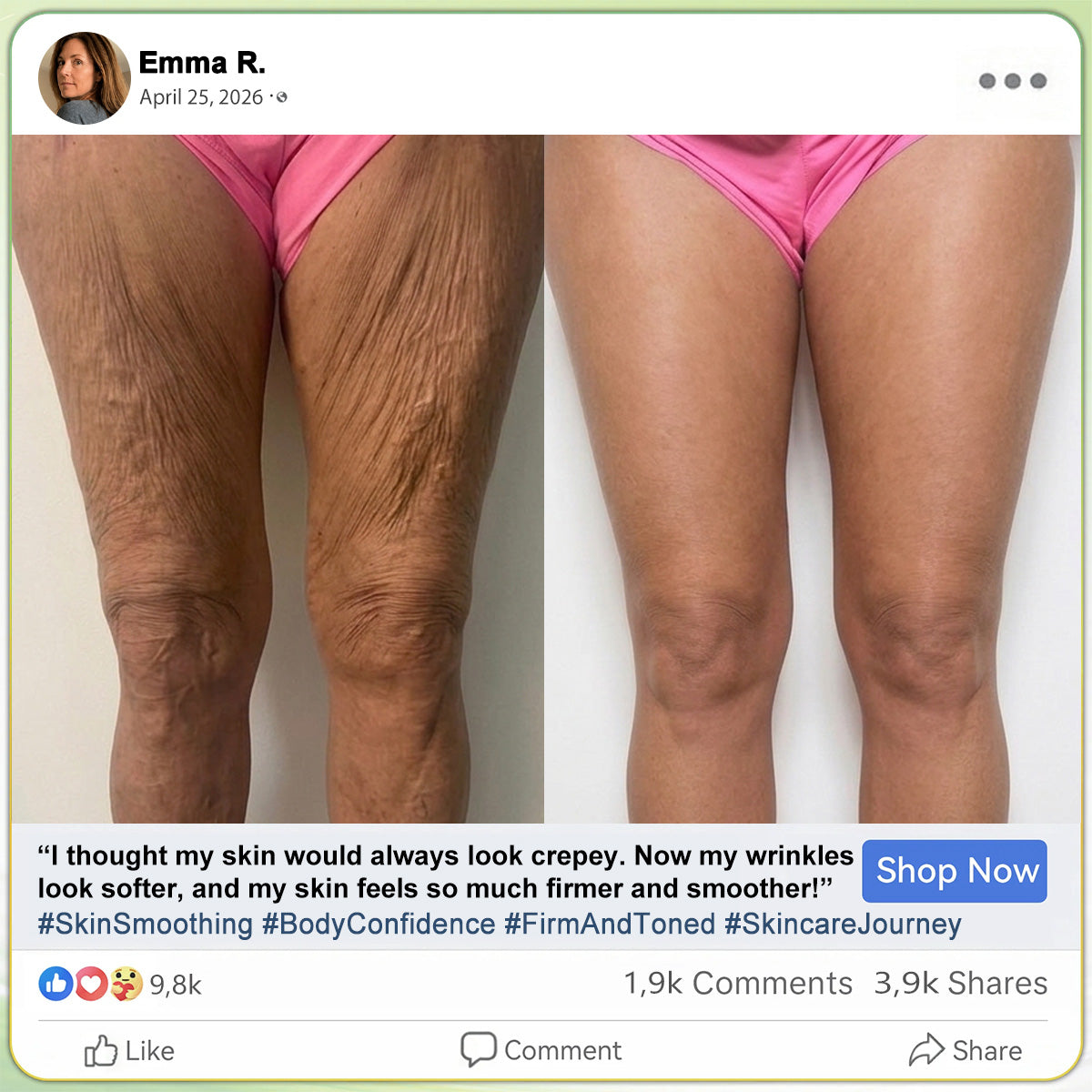 𝑯𝑰𝑺𝑲𝑰𝑵® PDRN Anti‑Aging & Targeted Spot Care(👨‍⚕️Helps Smooth Wrinkles, Support Firmer‑Looking Skin, and Improve The Appearance Of Visible Spots in 7 days🕑)