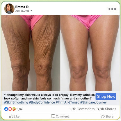 𝑯𝑰𝑺𝑲𝑰𝑵® PDRN Anti‑Aging & Targeted Spot Care(👨‍⚕️Helps Smooth Wrinkles, Support Firmer‑Looking Skin, and Improve The Appearance Of Visible Spots in 7 days🕑)