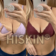 HISKIN® Bust Volume, Lift & Firming Nano Microneedle Patch Volufiline + Exosome + Copper Peptide Formula Powered by Cellular Renewal Technology (Copy)