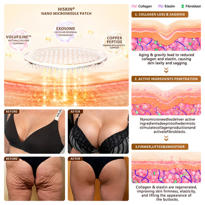 HISKIN®✨ Bust Volume, Lift & Firming Nano Microneedle Patch Volufiline + Exosome + Copper Peptide Formula Powered by Cellular Renewal Technology (Copy)