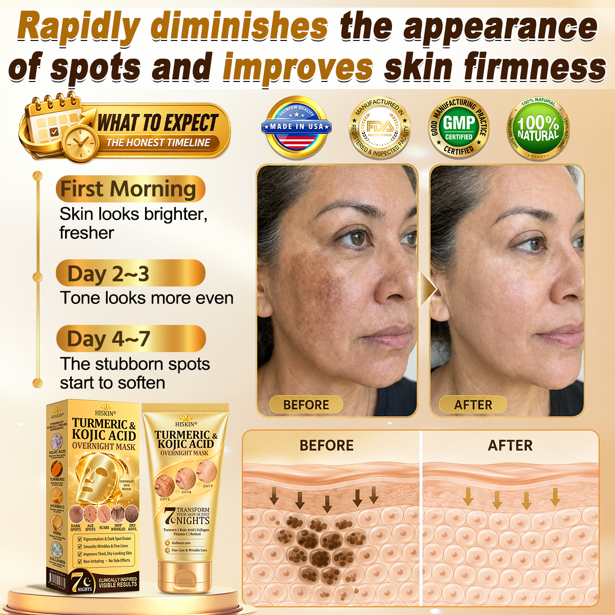 🇺🇸𝑶𝒇𝒇𝒊𝒄𝒊𝒂𝒍 𝑺𝒕𝒐𝒓𝒆|𝐍𝐞𝐰! 🆕🆕𝐇𝐢𝐬𝐤𝐢𝐧® 𝐓𝐮𝐫𝐦𝐞𝐫𝐢𝐜 × 𝐊𝐨𝐣𝐢𝐜 𝐀𝐜𝐢𝐝 𝐎𝐯𝐞𝐫𝐧𝐢𝐠𝐡𝐭 𝐏𝐞𝐞𝐥-𝐎𝐟𝐟 𝐌𝐚𝐬𝐤 — 𝐅𝐚𝐝𝐞 𝐒𝐭𝐮𝐛𝐛𝐨𝐫𝐧 𝐃𝐚𝐫𝐤 𝐒𝐩𝐨𝐭𝐬 & 𝐒𝐦𝐨𝐨𝐭𝐡 𝐕𝐢𝐬𝐢𝐛𝐥𝐞 𝐖𝐫𝐢𝐧𝐤𝐥𝐞𝐬 𝐖𝐡𝐢𝐥𝐞 𝐘𝐨𝐮 𝐒𝐥𝐞𝐞𝐩 🌙✨ 𝐓𝐮𝐫𝐦𝐞𝐫𝐢𝐜 × 𝐊𝐨𝐣𝐢𝐜 𝐀𝐜𝐢𝐝 × 𝐏𝐞𝐩𝐭𝐢𝐝𝐞𝐬 ✅ 𝐎𝐧𝐞 𝐒𝐭𝐞𝐩 𝐚 𝐍𝐢𝐠𝐡𝐭 · 𝐕𝐢𝐬𝐢𝐛𝐥𝐞 𝐂𝐡𝐚𝐧𝐠𝐞𝐬 𝐢𝐧 𝟕 𝐍𝐢𝐠𝐡𝐭𝐬 💯