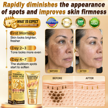 🇺🇸𝑶𝒇𝒇𝒊𝒄𝒊𝒂𝒍 𝑺𝒕𝒐𝒓𝒆|𝐍𝐞𝐰! 🆕🆕𝐇𝐢𝐬𝐤𝐢𝐧® 𝐓𝐮𝐫𝐦𝐞𝐫𝐢𝐜 × 𝐊𝐨𝐣𝐢𝐜 𝐀𝐜𝐢𝐝 𝐎𝐯𝐞𝐫𝐧𝐢𝐠𝐡𝐭 𝐏𝐞𝐞𝐥-𝐎𝐟𝐟 𝐌𝐚𝐬𝐤 — 𝐅𝐚𝐝𝐞 𝐒𝐭𝐮𝐛𝐛𝐨𝐫𝐧 𝐃𝐚𝐫𝐤 𝐒𝐩𝐨𝐭𝐬 & 𝐒𝐦𝐨𝐨𝐭𝐡 𝐕𝐢𝐬𝐢𝐛𝐥𝐞 𝐖𝐫𝐢𝐧𝐤𝐥𝐞𝐬 𝐖𝐡𝐢𝐥𝐞 𝐘𝐨𝐮 𝐒𝐥𝐞𝐞𝐩 🌙✨ 𝐓𝐮𝐫𝐦𝐞𝐫𝐢𝐜 × 𝐊𝐨𝐣𝐢𝐜 𝐀𝐜𝐢𝐝 × 𝐏𝐞𝐩𝐭𝐢𝐝𝐞𝐬 ✅ 𝐎𝐧𝐞 𝐒𝐭𝐞𝐩 𝐚 𝐍𝐢𝐠𝐡𝐭 · 𝐕𝐢𝐬𝐢𝐛𝐥𝐞 𝐂𝐡𝐚𝐧𝐠𝐞𝐬 𝐢𝐧 𝟕 𝐍𝐢𝐠𝐡𝐭𝐬 💯