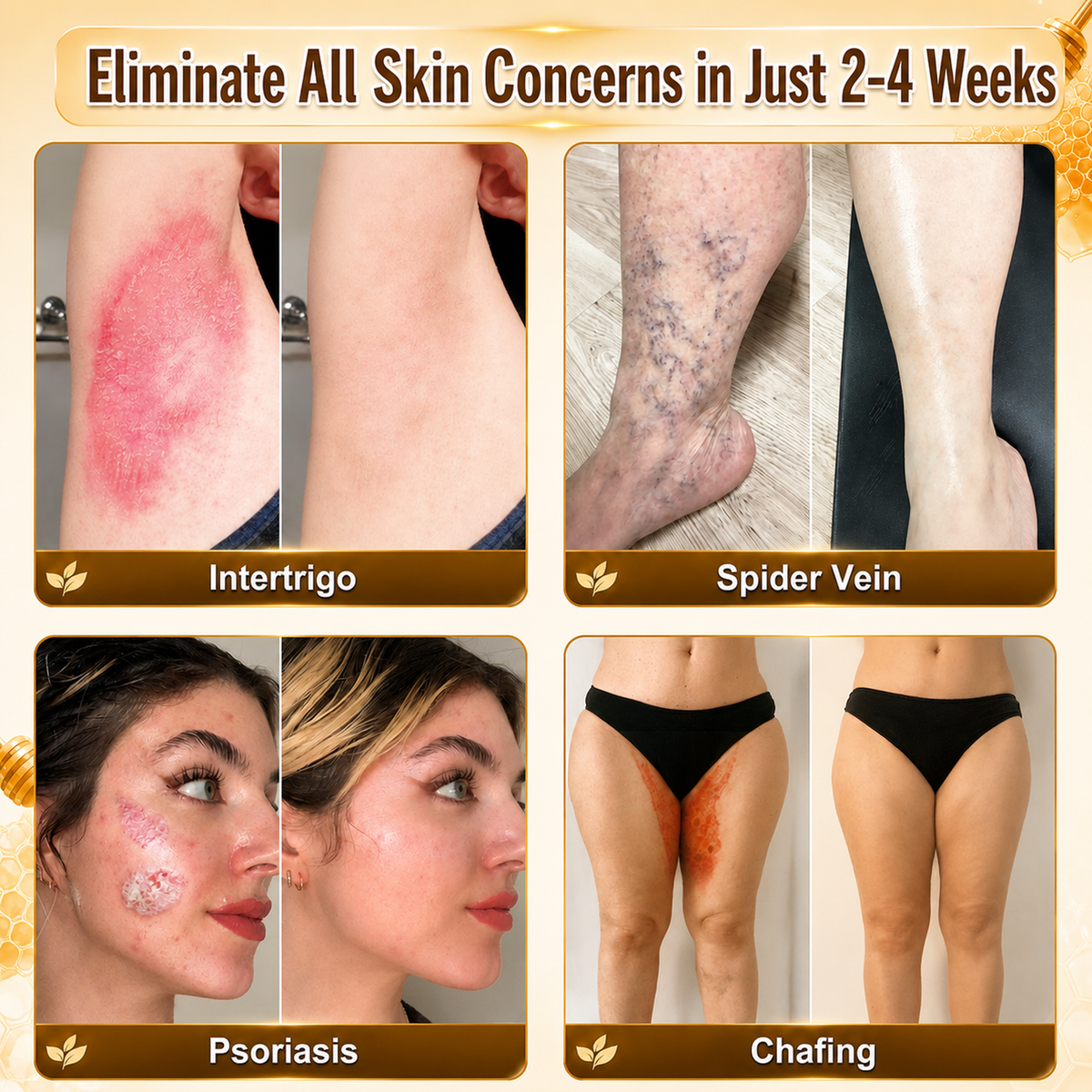 HISKIN® Multi-Concern Skin Repair Cream (One powerful cream to repair inflammation, dryness, aging, pigmentation, and visible skin damage.)