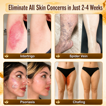 HISKIN® Multi-Concern Skin Repair Cream (One powerful cream to repair inflammation, dryness, aging, pigmentation, and visible skin damage.)